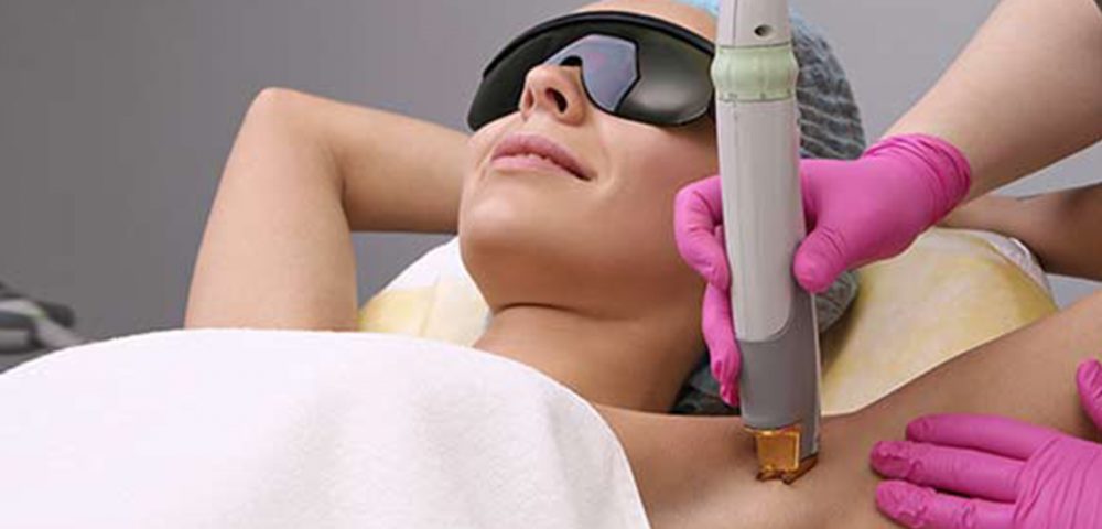 Laser Hair Removal